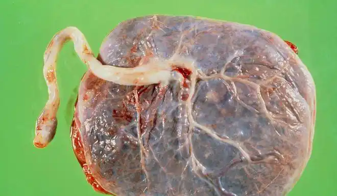 在日常生活中,相信各位网友都一定听闻过吃胎盘这件事.