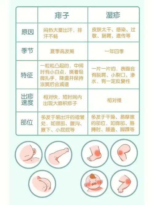 湿疹or痱子?98一张图让你简单区分