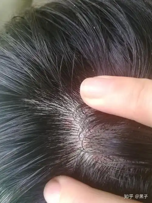 求帮忙看看什么情况