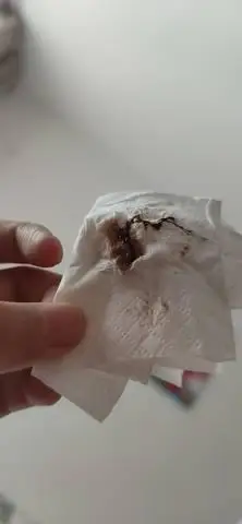 育儿问答 怀孕期 孕11周,一直有褐色物,,请问这黑色血丝是什么?