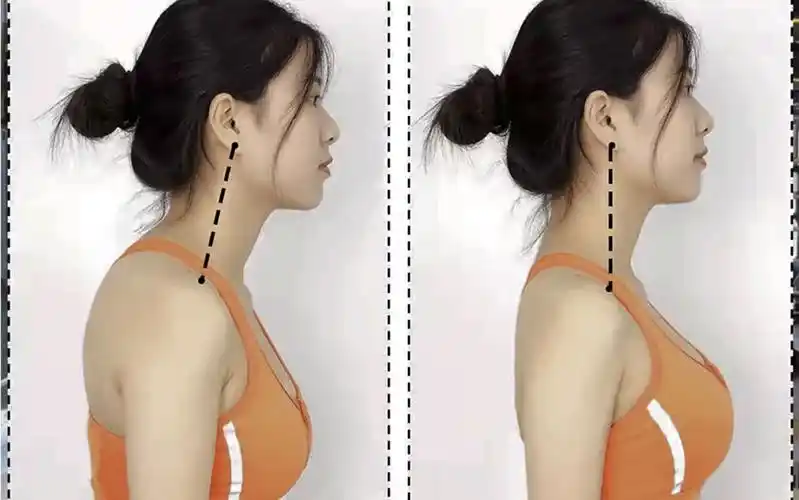 改善头前引富贵包