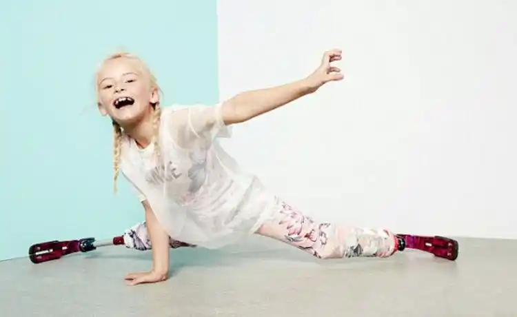 双腿截肢的7岁英国小姑娘装上义肢t台走秀,气场不输名模!