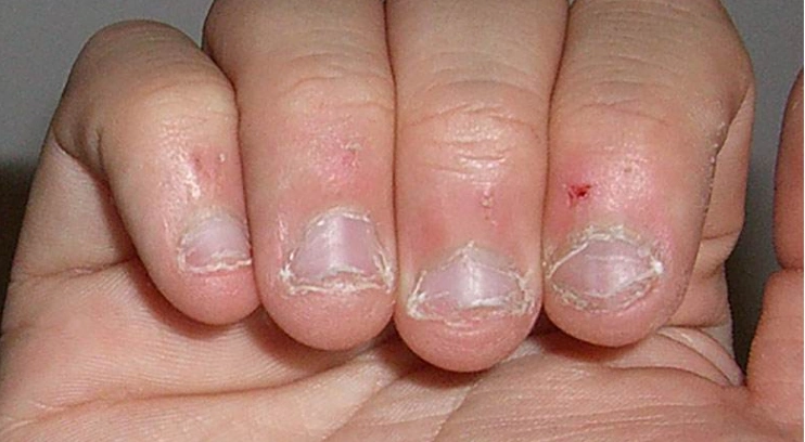 我们一起解密孩子啃手啃指甲的秘密