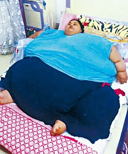 女子重500公斤出国减肥