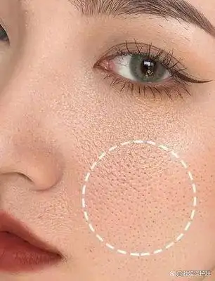 毛孔粗大怎么办预防比修护更重要