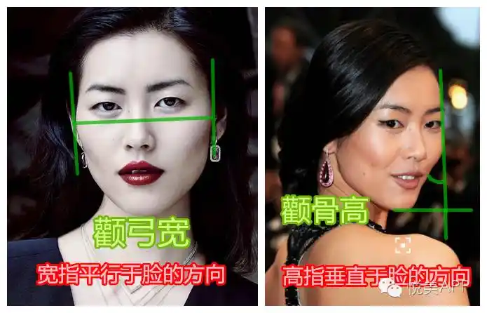 很多憨表妹,到现在还分不清颧骨高和颧弓宽的区别——颧骨突出很难看