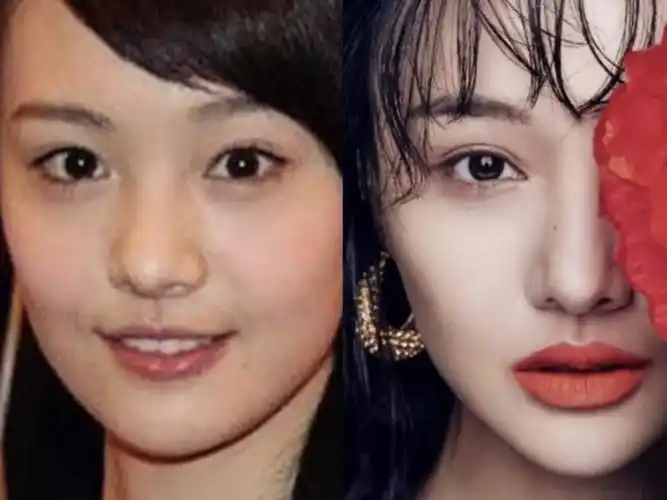 郑爽整容前后,这个变化也太大了吧751595郑爽可以说是_圈子