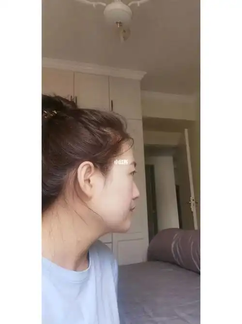 面部超级扁平  就像大饼脸  该怎么办上牙也有些突出矫正牙齿会有所