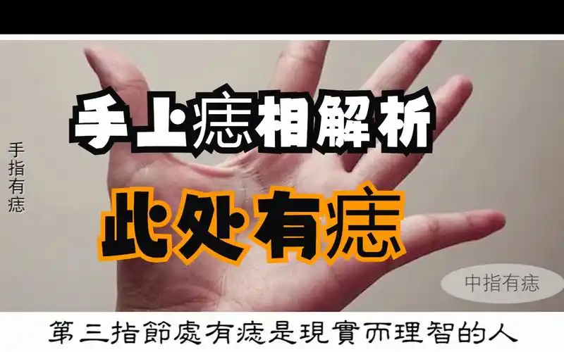 【痣相算命】手上痣相解析,此處有痣,是大富大貴之相