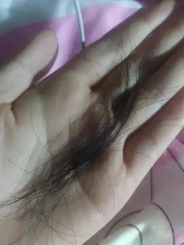 姐妹们急急急突然掉了一撮头发怎么办