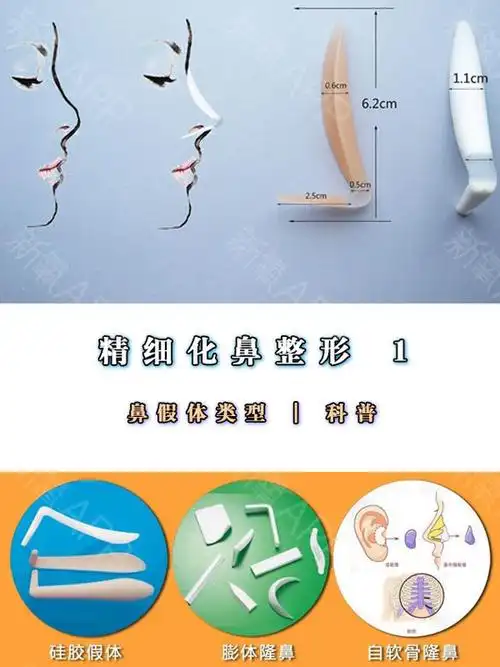 鼻假体类型   科普