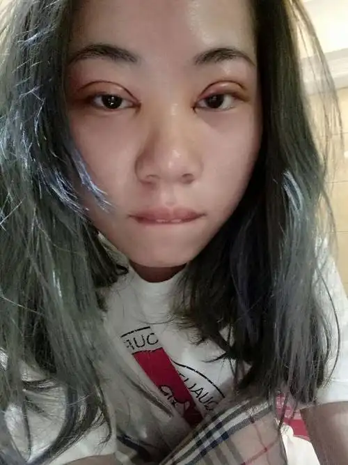 割完双眼皮,简直就是改变了我的人生
