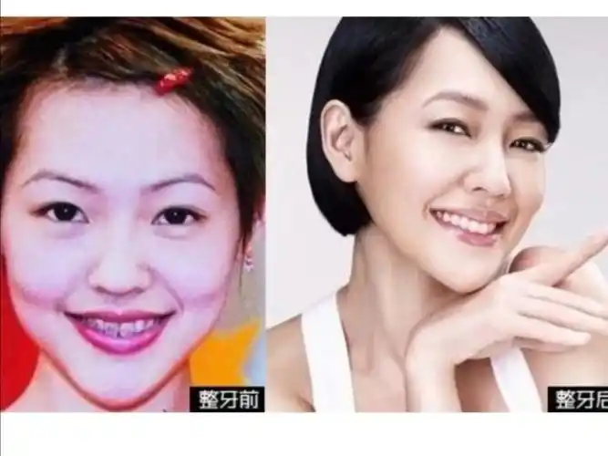 12岁小仙女就应该知道的变美小技巧