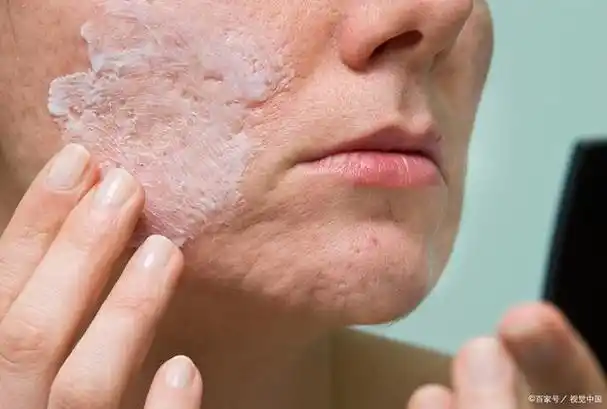 当你的皮肤缺水时,它会变得干燥,粗糙,失去弹性,并开始脱落.