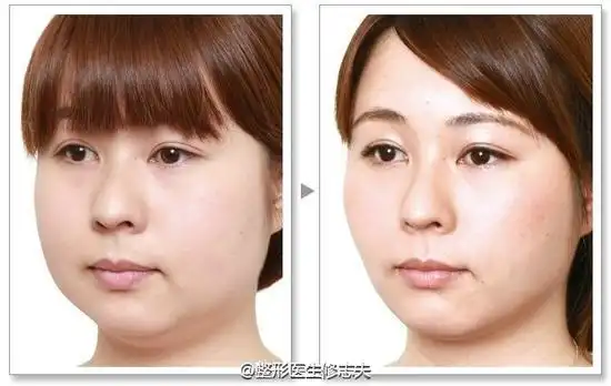 拿什么才能拯救大脸