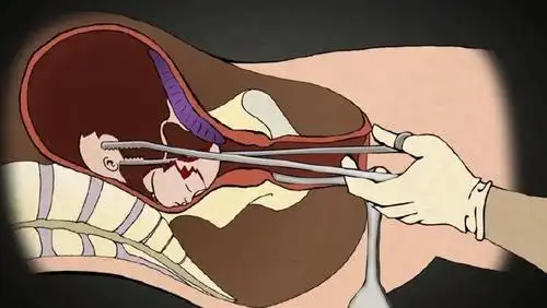 人工流产后,那些被打掉的胎儿都去哪了?真相太残忍!