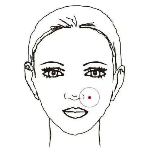 招小人痣:有此痣的人多会生活中常丢东西,工作中总是遇到作对的人.