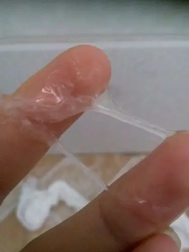 东莞长安白带呈乳白色糊状怎么回事