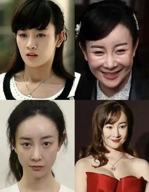 张檬取出假体后美出新高度戒酒戒应酬再得于正重用