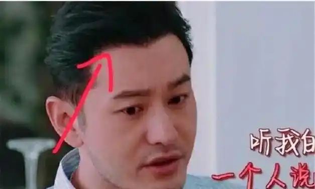 节目里假发套穿帮,头发分层明显,早年已有征兆|鬓角|发际线_网易订阅