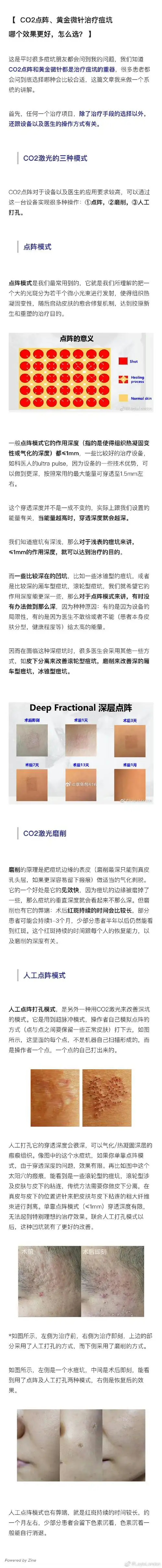 微博颜选##微博变美手册##章鱼包医美功课