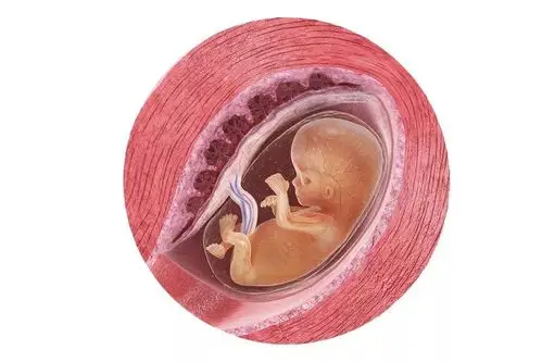 胎盘植入丨每100个孕妈就有7个因此而失去生命!_子宫