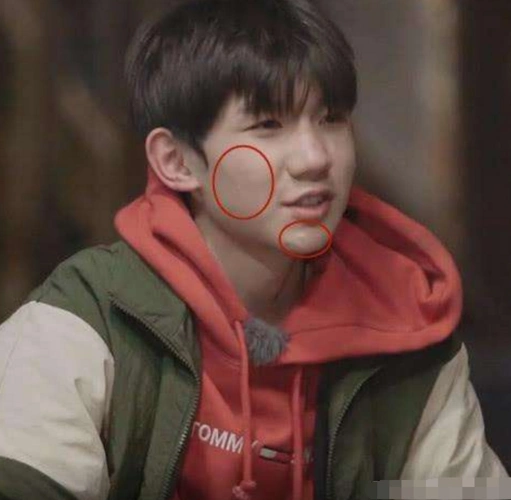 有种整容叫王源抽烟,未修图满脸痘印不敢相信,粉丝直呼:太失望