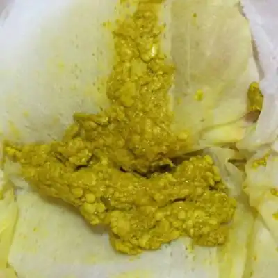 这样的大便正常吗?宝妈们帮忙看看吧