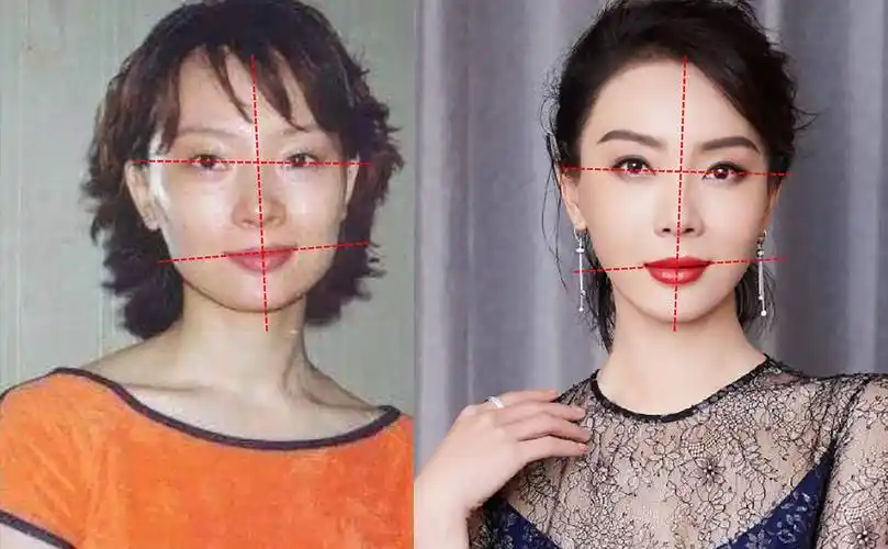 长得"歪瓜裂枣",整得"美若天仙",这5位女明星靠脸逆天改命_陈数_杨颖