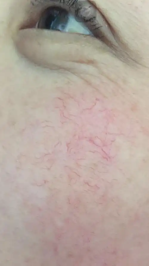 红血丝~女人心中永远都说不出的痛!