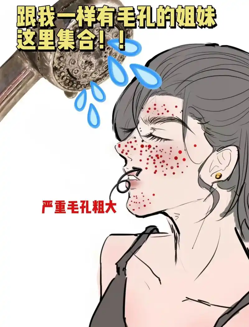 关键时刻还是得靠它,素颜嫩到掐出水~.黑头多,毛孔粗大的宝子 - 抖音