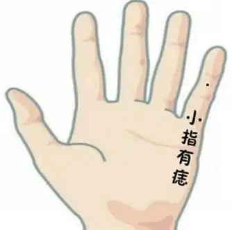 手指长痣的寓意,哪根手指长痣桃花多