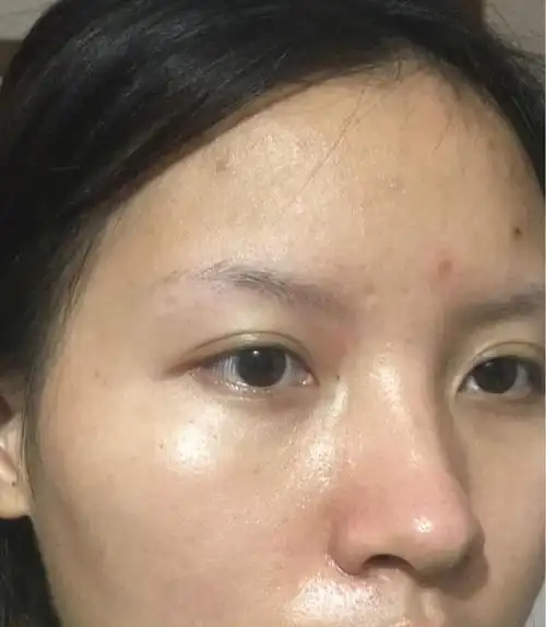 女人皮肤发黄,暗沉的五大原因!前2个很常见,想改掉却很难