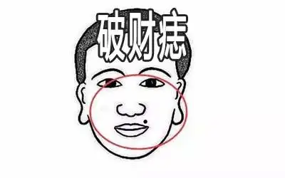 脸上的破财痣长在什么地方