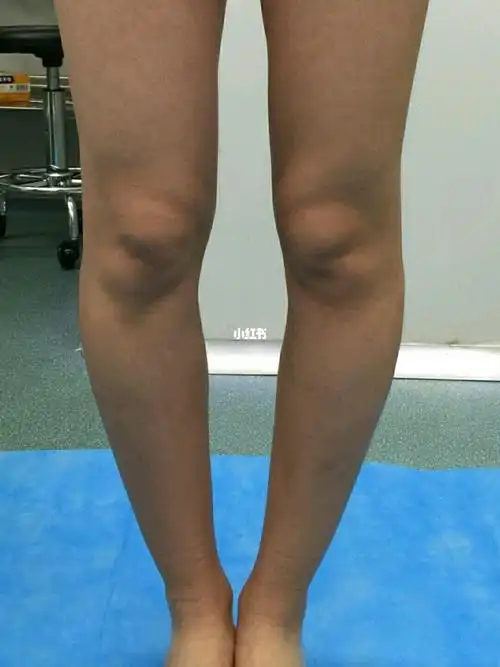 这弯腿竟然变得超直,我都不敢想_穿搭_美腿_穿衣_腿型矫正_减肥_减肥