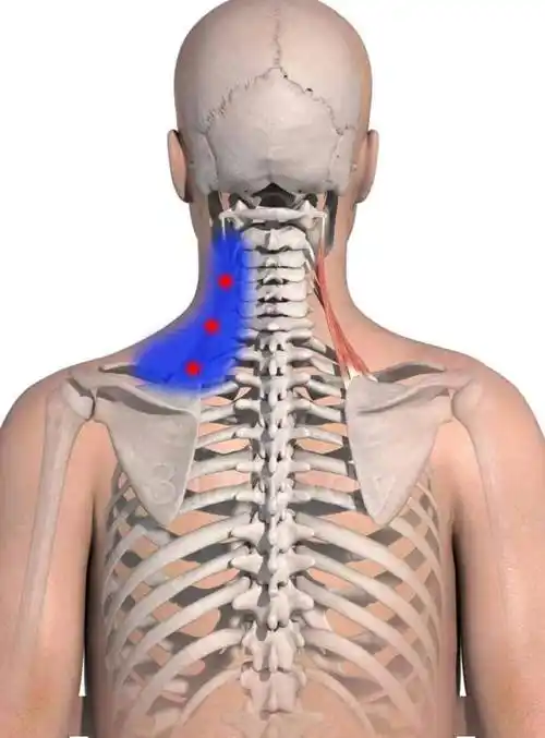 肩颈解剖之斜菱肩提肌和疼痛触发点_临床_肩胛_医学