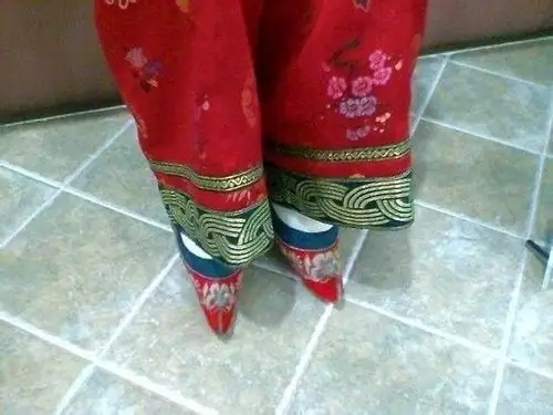 慎入! 29岁女花6年缠足 前掌完全萎缩,走不到百步 | et fashion | ett