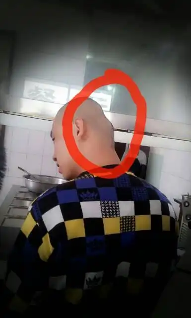 这叫脑生反骨吗?