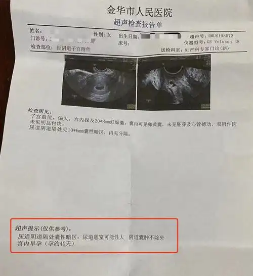 女子称b超未查出怀孕被开禁服药导致打胎,金华妇幼保健院:正协商|金华