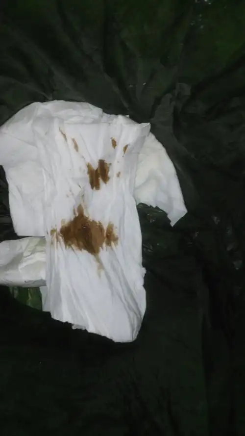 剖腹产一年了,现在又怀孕了,七周的时候去检查胎好好的,现在八周了