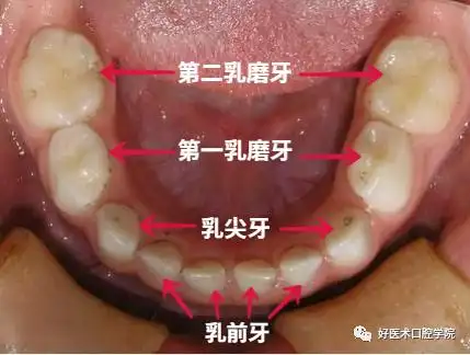牙科医生给孩子的护牙秘籍,除了刷牙还多做了这一点! - 好医术早读文