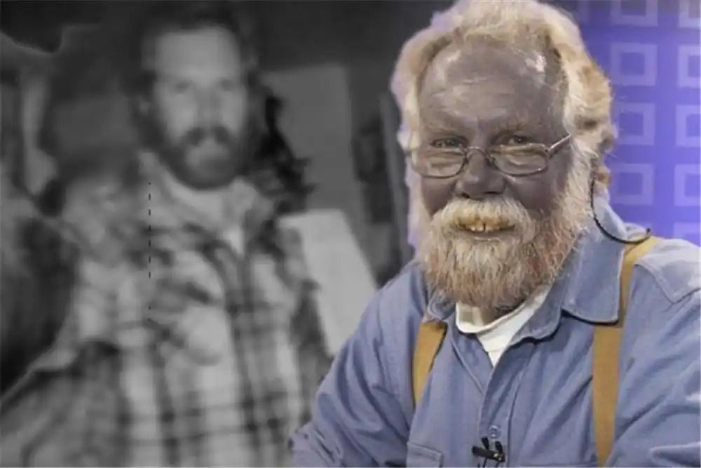 地球上尊贵的蓝种人,生活在海拔6千米的深山,100多年仅露面一次