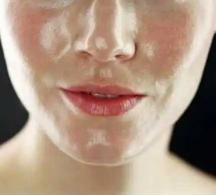 脸上出油厉害是什么原因呢?为什么脸上会老出油?