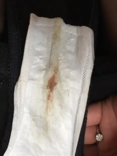 怀孕两个多月出了点红血是先兆流产吗 危险吗只看楼主