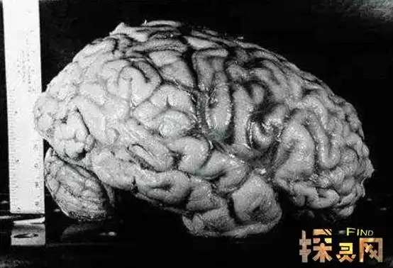 1997年,哈维医师决定把所有的大脑切片送还爱因斯坦生前工作的