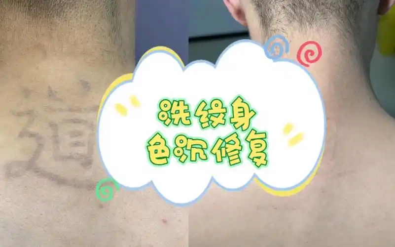 洗纹身清洗对比