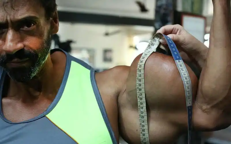 巴西男子向肌肉注射燃油 手臂粗60厘米(组图)(5/6)