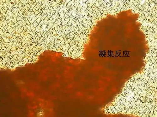 血型与交叉配血试验(修改)ppt