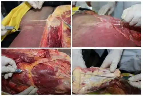 没有解剖学就没有医学——2019年1月12日全国第十一届深圳新鲜尸体