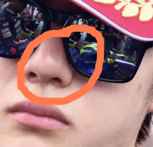 王一博再被质疑整容?看高清怼脸素颜照后网友:手术痕迹好重